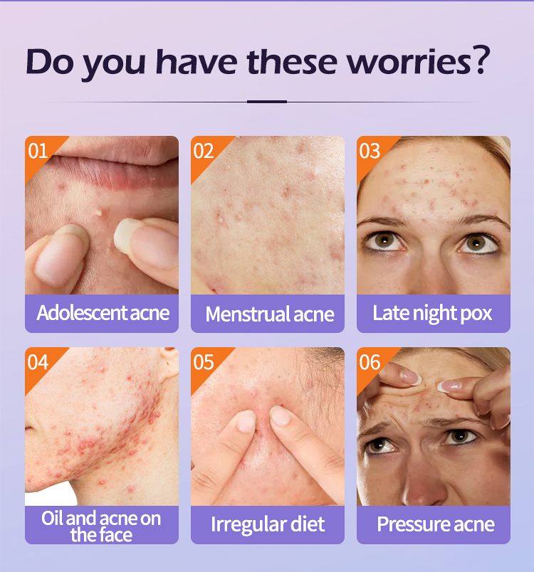 Acne Patch Manufacturer