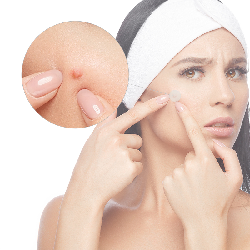 Пластырь от прыщей